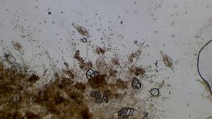 грязная вода под микроскопом