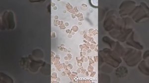 Кровь под микроскопом.