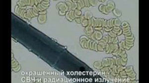 Сканирование живой капельки крови под микроскопом. Как много там интересного!