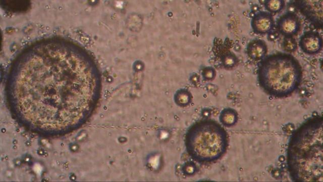 верёвочный червь в среде озонированного масла чёрного тмина слабой озонации , первые 30 минут теста смотреть онлайн