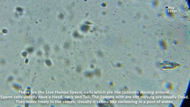 | HUMAN SPERM CELL | MOMENTS | 250x,1125X, 2500X | MOTILITY | MICROSCOPIC VIEW | смотреть онлайн