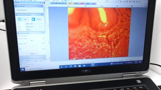 Leica DM6000 B LED Fluorescence Motorized Microscope [BOSTONIND] - 32263 смотреть онлайн