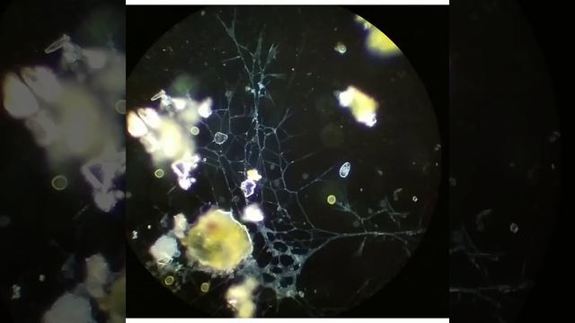 Не как не определить что это, может кто знает? Напишите. Вода из пруда. Увеличение 125x vs 250x. смотреть онлайн