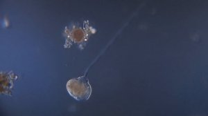 Инфузория-сувойка