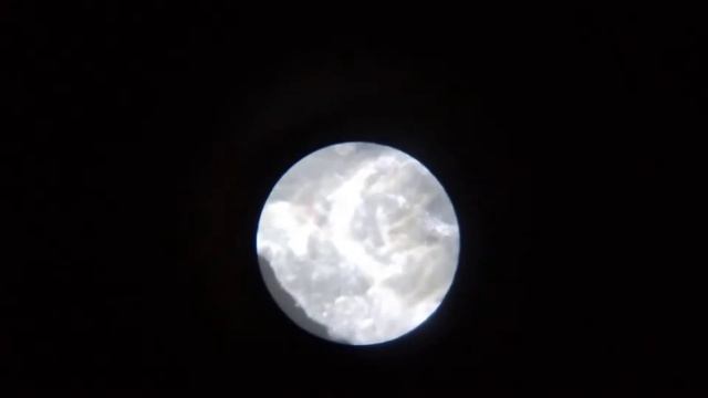 Кожа человека под микроскопом смотреть онлайн