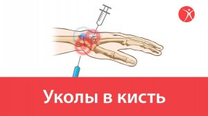 Уколы в кисть