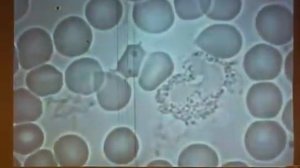 Темнопольный микроскоп О.Бутакова