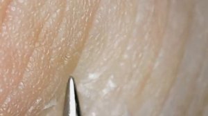 Кожа под микроскопом