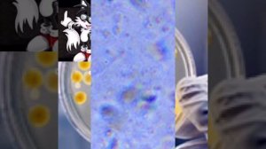 Неизвестные бактерии под микроскопом