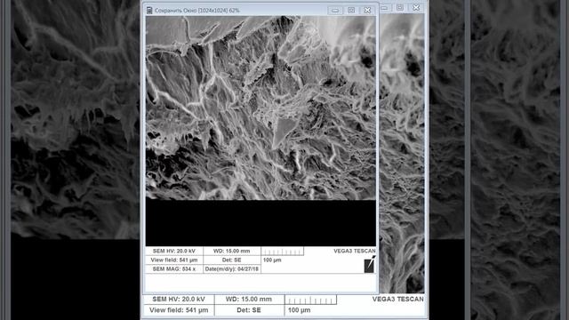 Миры электронной микроскопии: молочный зуб milk tooth