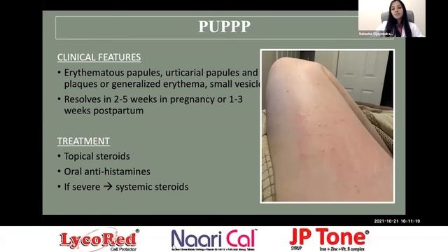 Common Complications in Pregnancy. NURTURING BIRTH E.5 смотреть онлайн