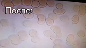 Кровь под микроскопом.