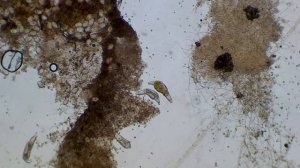 грязная вода под микроскопом