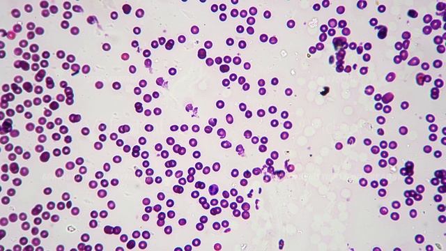 Smear of human blood under microscope with 400 times magnification on bright field смотреть онлайн