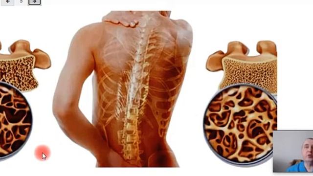 Сокровища, скрытые в вашем позвоночнике (а вы даже не догадываетесь!) смотреть онлайн