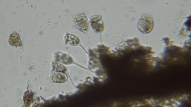 Vorticella - mikroskop #2 смотреть онлайн