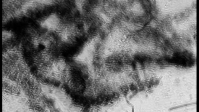 Konjugation von Spirogyra unter dem Linsenlose Mikroskop 60 Grad. Blau-  Roter- Kanal wählen.