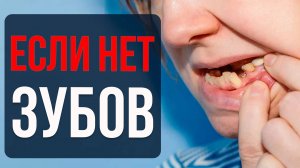 Можно ли Поставить Виниры, если Нет Зубов? Узнай, что Делать!