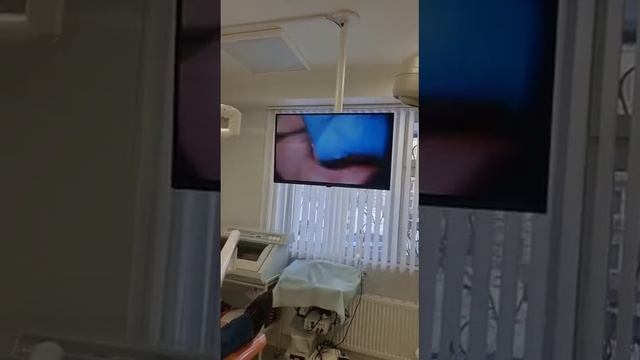 Лечение зубов под микроскопом в «GM Clinica» смотреть онлайн