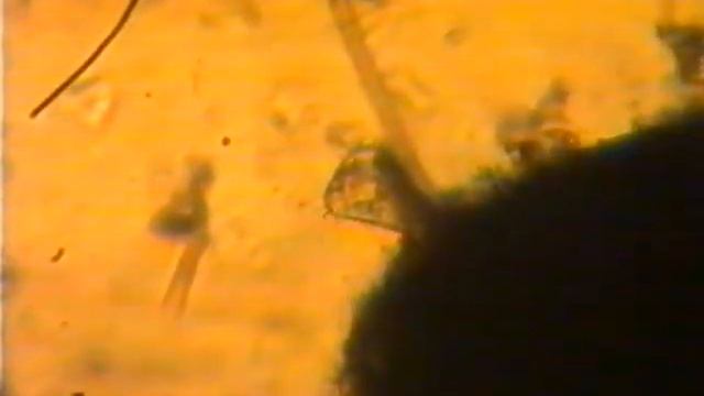 1998 год Видеозапись через микроскоп смотреть онлайн