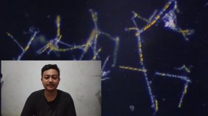 Tugas Planktonologi Fitoplankton Skeletonema Muhammad Eko Susanto MSP FPIK UHO