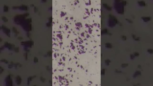 Под микроскопом смотреть онлайн