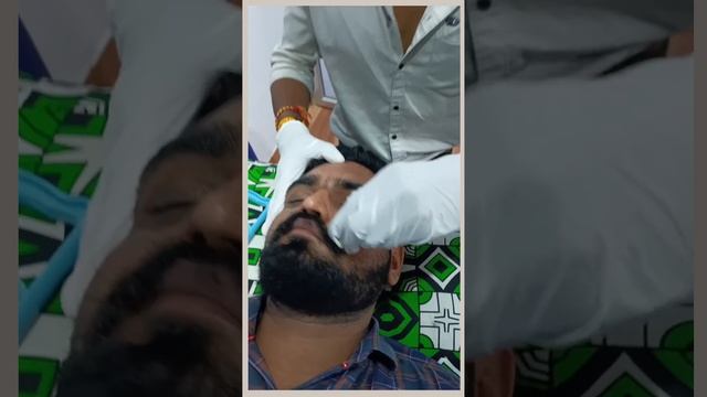 The Scary Truth About Facial Cupping Results👹 doctor pimple popper #Cupping смотреть онлайн