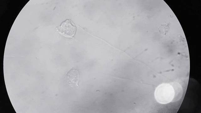 Инфузория сувойка под микроскопом смотреть онлайн