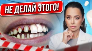 ВИНИРЫ: это должны знать все! 😱Что нужно сделать ДО установки, когда нельзя ставить и кому нужны