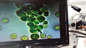 ЖИВАЯ ХЛОРЕЛЛА   чудеса под микроскопом!  Аврора