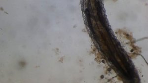 червь под микроскопом