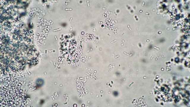 Microscopic milk bacilli float in the leaven in the microscope смотреть онлайн