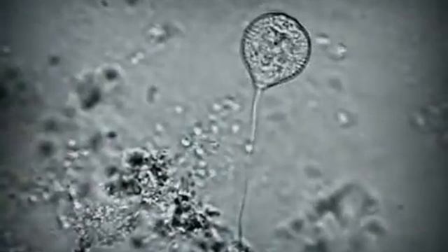 Vorticella sphaerica смотреть онлайн