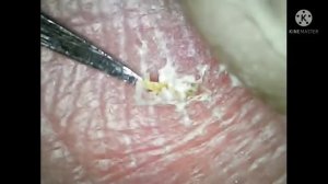 Обзор цифрового микроскопа,увиличение 1600 раз.