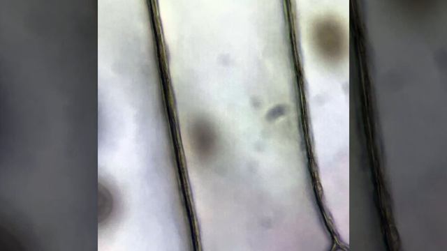 Лук в микроскоп, HDR