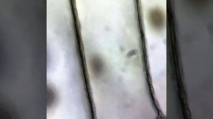 Лук в микроскоп, HDR