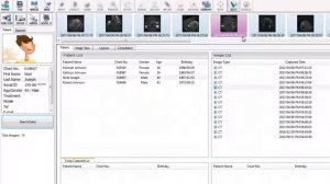 Exporting Dicom Files from EZdent