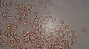 заражение крови. микроскопия slw2022 04 06 00 47 31