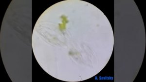 Деление инфузоии Стилонихии под микроскопом. 630х / Division of ciliate of Stylonychia