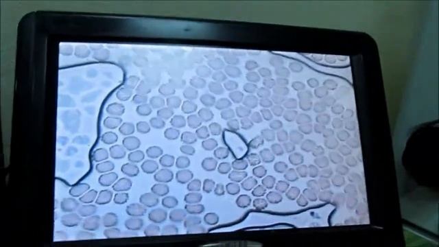гемосканирование. врач Верхотурцева. тестируем кофе с фуллеренами смотреть онлайн