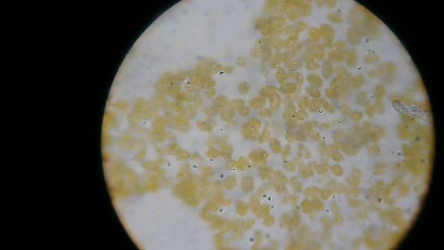 Визначаю культуру водорості чи ціанобактерії? I determine the culture of algae or cyanobacteria?