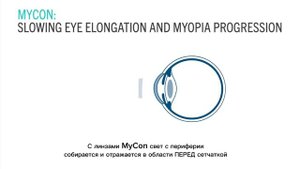 Rodenstock MyCon линзы замедляющие развитие детской блирукости