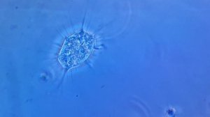 Передвижение амебы. 1000х. Скорость 5х \ Amoeba movement. 1000х. speed 5х