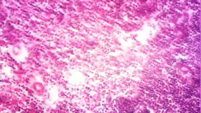 Lymph node section смотреть онлайн