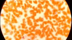 Отличие крови лягушки и человека