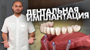 Дентальная имплантация с расщеплением костного гребня