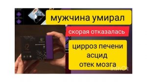 Врачи отказались. Цирроз печени. Асцид. Отёк мозга. Ватсапп +79088792908