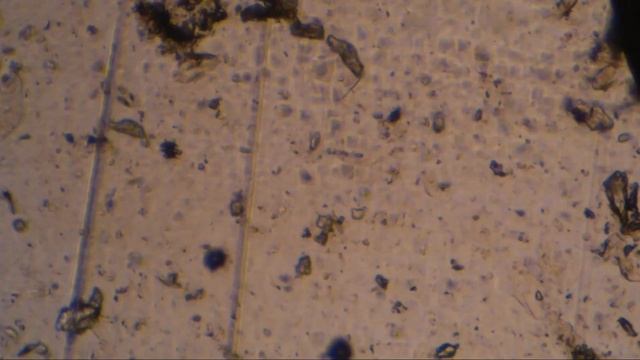 538 Seilwurm плюс магний с витамином B6 смотреть онлайн