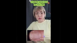Ставим диагноз по ногтям