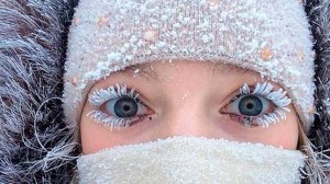 У тебя на ресницах.